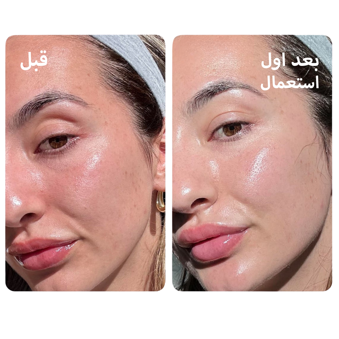 Pack Charbon Actif : سرّ النضارة واللمعان الصحي لبشرة صافية ومشرقة.