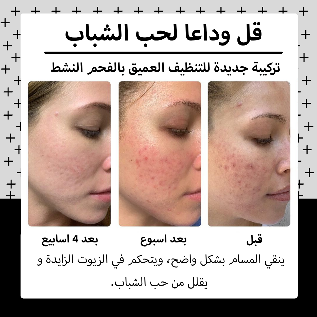 Pack Charbon Actif : سرّ النضارة واللمعان الصحي لبشرة صافية ومشرقة.