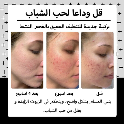 Pack Charbon Actif : سرّ النضارة واللمعان الصحي لبشرة صافية ومشرقة.